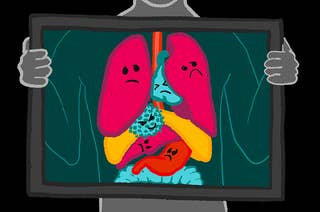 An illustration of a person holding an X-Ray frame in front of their torso. The organs have frowning faces. There is a coronavirus cell in the body with a mean face